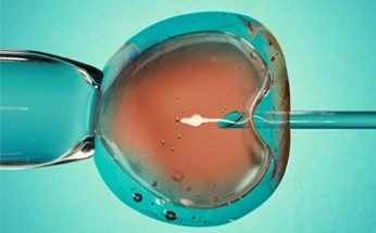 ivf and infertility treatment
